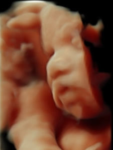 3D scan of a babies face